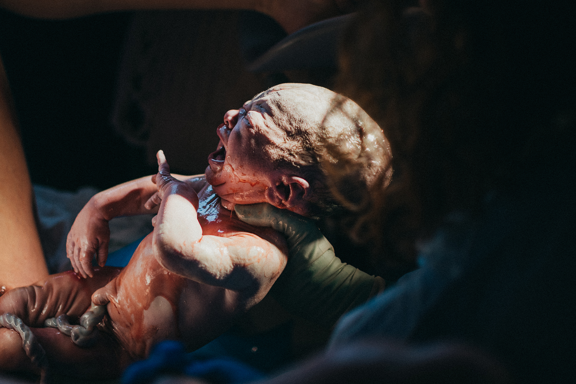 In between words, a newborn baby all covered in goo is delivered by an obstetrician In between words, a newborn baby all covered in goo is delivered by an obstetrician